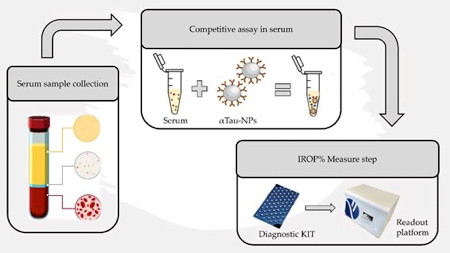 Nuevo procedimiento para diagnosticar el Alzheimer
