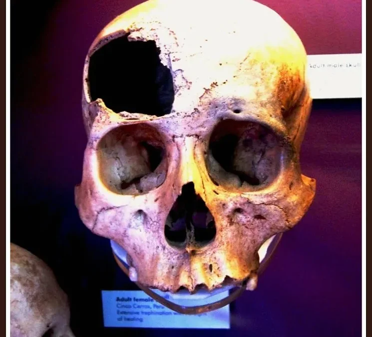 Los Incas: los primeros neurocirujanos de la historia